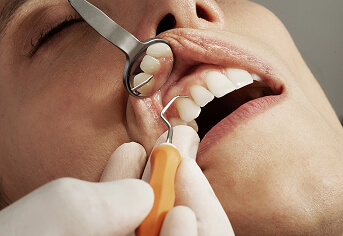 Stomatologie estetică